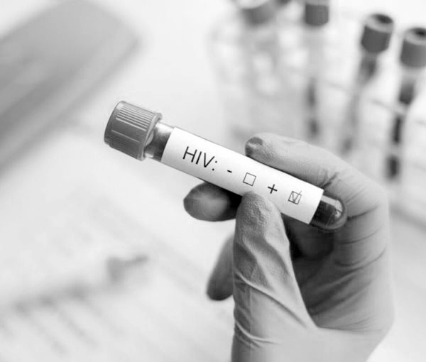 زنگ خطر کاهش سن ابتلا به HIV به صدا درآمد