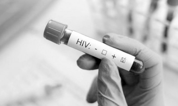 زنگ خطر کاهش سن ابتلا به HIV به صدا درآمد